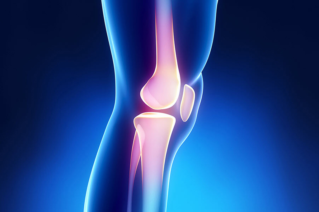 Knee Prosthesis banner (The Health Store Turkey)
